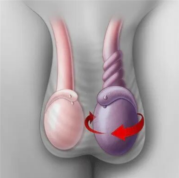 14 岁男孩睾丸疼 亲妈迷信 AI 硬拖两天！最后只能切掉了