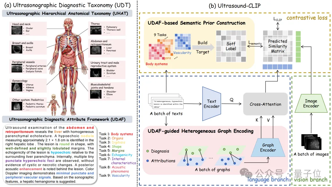 中国团队首创 36.4 万超声图文对数据集，助力 AI 读懂临床诊断语义丨 CVPR'26 AI快讯网