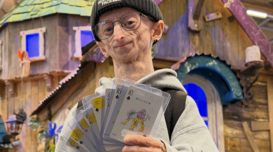 早衰症网红28岁去世!面容枯槁已是